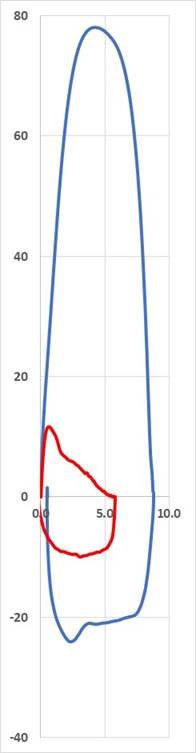 NDD - Spirometry - spirometer - peak flow rate