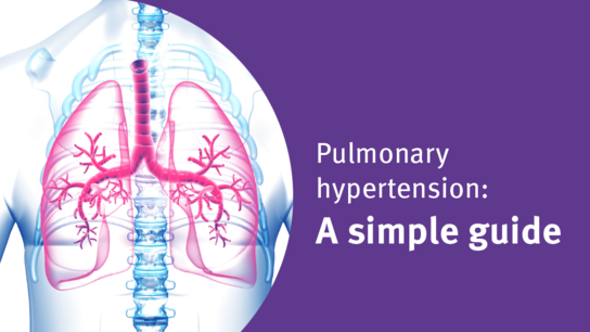 Una guía sencilla sobre la hipertensión pulmonar 