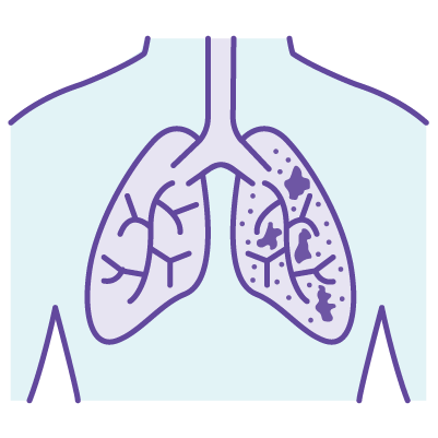 COPD solutions