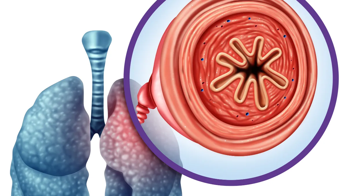 The importance of DLCO in diagnosing COPD. 